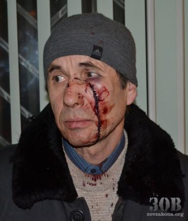 Титушки избили желающих ехать в Киев на Евромайдан (ФОТО) (ВИДЕО) Титушки избили желающих ехать в Киев на Евромайдан (ФОТО) (ВИДЕО)