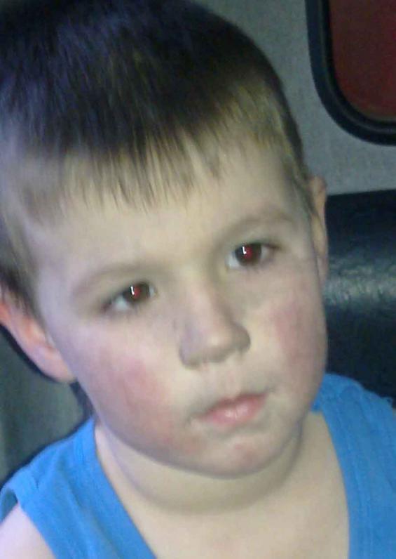 В Днепропетровске дети чуть не сожгли квартиру, пока мать спала В Днепропетровске дети чуть не сожгли квартиру, пока мать спала