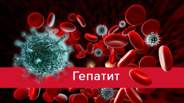 В школе Днепра зафиксирован случай заболевания гепатитом
