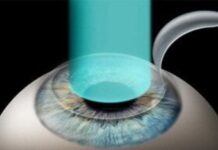 Професійна лазерна корекція та діагностика зору